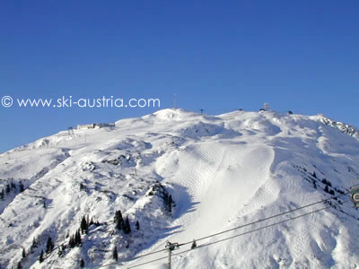 Sankt Anton Ski